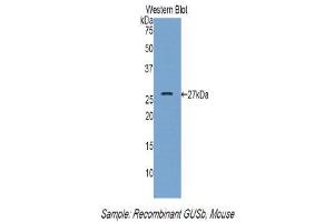 Western Blotting (WB) image for anti-Glucuronidase, beta (GUSB) (AA 451-648) antibody (ABIN1859100)