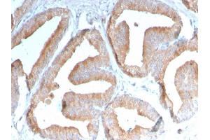 Immunohistochemistry (IHC) image for anti-Inducible T-Cell Co-Stimulator Ligand (ICOSLG) (AA 23-149) antibody (ABIN6939407)