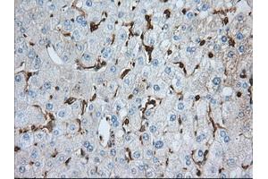 Immunohistochemical staining of paraffin-embedded prostate tissue using anti-ALDH3A1 mouse monoclonal antibody. (ALDH3A1 Antikörper)
