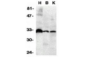 Western Blotting (WB) image for anti-Tumor Necrosis Factor Receptor Superfamily, Member 6b, Decoy (TNFRSF6B) (N-Term) antibody (ABIN1031347) (TNFRSF6B Antikörper  (N-Term))