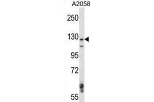 Western Blotting (WB) image for anti-Mitogen-Activated Protein Kinase Kinase Kinase 6 (MAP3K6) antibody (ABIN2997620) (MAP3K6 Antikörper)
