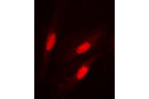 Immunofluorescent analysis of Beta-catenin (pS37) staining in HeLa cells. (beta Catenin Antikörper  (N-Term, pSer37))