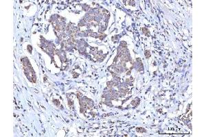 IHC analysis of C18orf22/RBFA using anti-C18orf22/RBFA antibody (ABIN7600106). (RBFA Antikörper  (AA 15-319))
