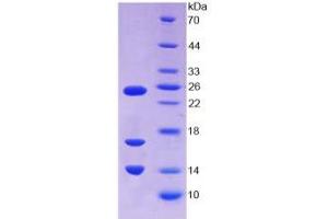 SDS-PAGE analysis of Human CAMP Protein. (Cathelicidin Antimicrobial Peptide (CAMP) Peptid)