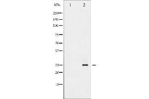 Western blot analysis of TNNI3 phosphorylation expression in Jurkat whole cell lysates,The lane on the left is treated with the antigen-specific peptide.