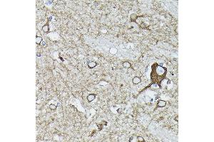 Immunohistochemistry of paraffin-embedded human brain using [KO Validated] Calreticulineticulin Rabbit pAb (ABIN3021344, ABIN3021345, ABIN3021346 and ABIN6214923) at dilution of 1:100 (40x lens). (Calreticulin Antikörper)