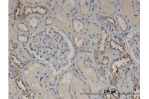 Image no. 2 for anti-Calmodulin-Like 5 (CALML5) (AA 1-147) antibody (ABIN599566) (CALML5 Antikörper  (AA 1-147))