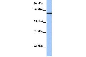 WB Suggested Anti-MLLT3 Antibody Titration:  0. (AF9 Antikörper  (N-Term))