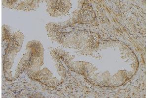 ABIN6277903 at 1/100 staining Mouse colon tissue by IHC-P. (UCP1 Antikörper  (Internal Region))