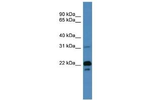WB Suggested Anti-BASP1 Antibody Titration: 0. (BASP1 Antikörper  (N-Term))