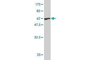 Western Blot detection against Immunogen (60. (PRKRA Antikörper  (AA 1-313))