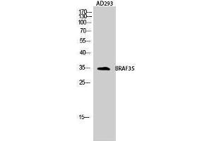 Western Blotting (WB) image for anti-High Mobility Group 20B (HMG20B) (N-Term) antibody (ABIN3183539) (HMG20B Antikörper  (N-Term))