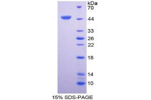 SDS-PAGE (SDS) image for Interleukin 6 (IL6) (AA 29-212) protein (GST tag) (ABIN1878195)