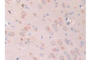 Immunohistochemistry (IHC) image for anti-Slit Homolog 1 (SLIT1) (AA 308-512) antibody (ABIN7438097)