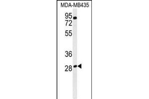 Western blot analysis of RRAGD Antibody (Center) (ABIN651150 and ABIN2840101) in MDA-M cell line lysates (35 μg/lane). (RRAGD Antikörper  (AA 171-199))