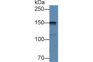 Detection of COL4a5 in Porcine Cerebrum lysate using Polyclonal Antibody to Collagen Type IV Alpha 5 (COL4a5) (COL4a5 Antikörper  (AA 1461-1685))