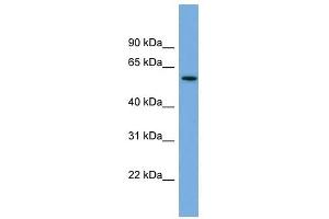 AK5 antibody used at 1 ug/ml to detect target protein. (Adenylate Kinase 5 Antikörper  (N-Term))