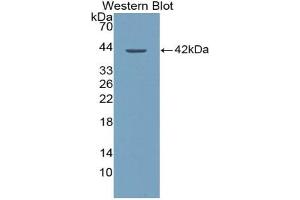 Western blot analysis of the recombinant protein. (XCL1 Antikörper  (AA 23-113))