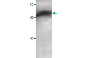 Western blot analysis of human fetal brain lysate with ADAM10 polyclonal antibody  at 1 : 1000 dilution. (ADAM10 Antikörper  (C-Term))
