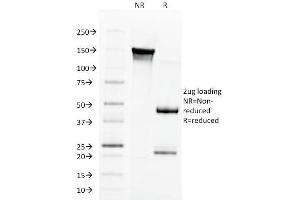 SDS-PAGE Analysis Purified Aurora B Mouse Monoclonal Antibody (AURKB/1592). (Aurora Kinase B Antikörper  (AA 89-251))