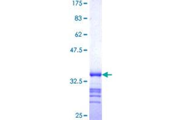WRB Protein (AA 29-101) (GST tag)