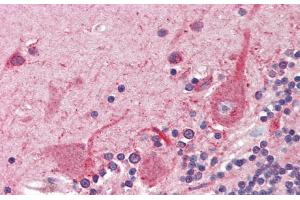 Immunohistochemistry with Human Braun, cerebellum tissue at an Antibody concentration of 5.