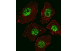 Fluorescent image of A549 cell stained with SOX2 Antibody (ABIN387798 and ABIN2843854)/SG110310. (SOX2 Antikörper)