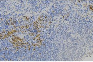 ABIN6277802 at 1/100 staining Human lymph node tissue by IHC-P. (S100A9 Antikörper)