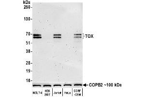 Western Blotting (WB) image for anti-Thymus High Mobility Group Box Protein (TOX) (AA 50-100) antibody (ABIN7453374) (Rekombinanter TOX Antikörper  (AA 50-100))