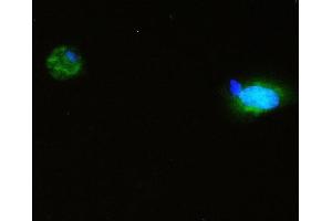 IF analysis of SQSTM1 using anti-SQSTM1 antibody (ABIN3043937). (SQSTM1 Antikörper  (N-Term))