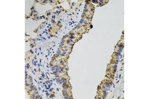 Immunohistochemistry of paraffin-embedded mouse lung using DNM2 antibody. (DNM2 Antikörper)