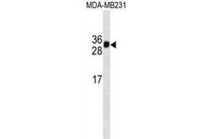 HKLK3 Antibody  (ABIN1538730 and ABIN2837840) western blot analysis in MDA-M cell line lysates (35 μg/lane). (Prostate Specific Antigen Antikörper  (AA 220-250))