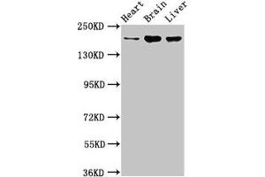 Western Blot Positive WB detected in: Rat heart tissue, Mouse brain tissue, Mouse liver tissue All lanes: ARFGEF2 antibody at 3. (ARFGEF2 Antikörper  (AA 200-317))