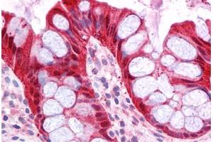 Immunohistochemistry (Formalin-fixed Paraffin-embedded Sections) (IHC (fp)) image for anti-Fatty Acid Binding Protein 1, Liver (FABP1) (N-Term) antibody (ABIN604753)