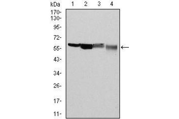 Glucose-6-Phosphate Dehydrogenase Antikörper