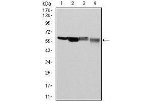 Western blot analysis using G6PD mouse mAb against Hela (1), MCF-7 (2), Jurkat (3) and K562 (4) cell lysate. (Glucose-6-Phosphate Dehydrogenase Antikörper)