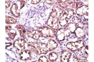 Immunohistochemistry (Paraffin-embedded Sections) (IHC (p)) image for anti-Solute Carrier Family 10 (Sodium/bile Acid Cotransporter Family), Member 2 (SLC10A2) (AA 131-230) antibody (ABIN755143)