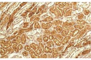 Immunohistochemistry of paraffin-embedded Human kidney tissue using IL8 Monoclonal Antibody at dilution of 1:200. (IL-8 Antikörper)