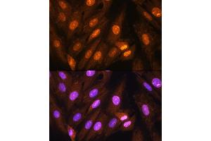 Immunofluorescence analysis of H9C2 cells using PP1 beta Rabbit pAb (ABIN6128486, ABIN6146055, ABIN6146057 and ABIN6217560) at dilution of 1:100. (PPP1CB Antikörper  (AA 1-327))