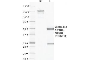 SDS-PAGE Analysis Purified VEGF Mouse Monoclonal Antibody (VG1). (VEGFA Antikörper)