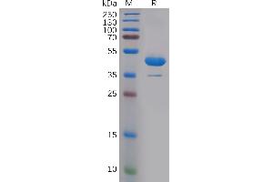 SDS-PAGE (SDS) image for Interleukin 1 alpha (IL1A) (AA 113-271) protein (Fc Tag) (ABIN6964364)