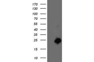 Western Blotting (WB) image for anti-Centromere Protein H (CENPH) antibody (ABIN1497471)