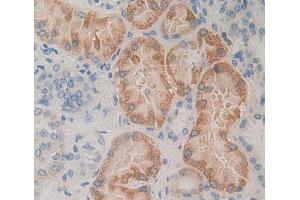 Used in DAB staining on fromalin fixed paraffin- embedded kidney tissue (PLTP Antikörper  (AA 337-479))