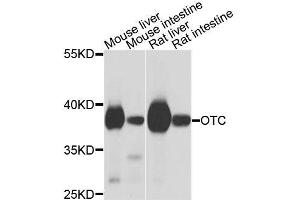 Western blot analysis of extracts of various cell lines, using OTC antibody (ABIN6003566) at 1/1000 dilution. (OTC Antikörper)