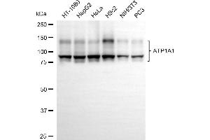 Western blotting analysis using ATP1A1 antibody (ABIN7800384).