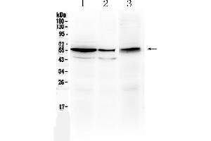 Western blot analysis of ALDH1A3 using anti- ALDH1A3 antibody .