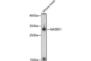 Western blot analysis of extracts of mouse heart, using M antibody (ABIN7268457) at 1:1000 dilution.