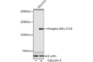 Western blot analysis of extracts of NIH/3T3 cells, using Phospho-IRE1-S724 antibody  at 1:500 dilution. (ERN1 Antikörper  (pSer724))