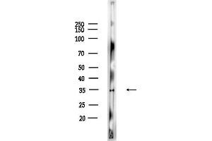 anti-Tumor Necrosis Factor-Inducible Protein 6 (TNFAIP6) (N-Term) antibody