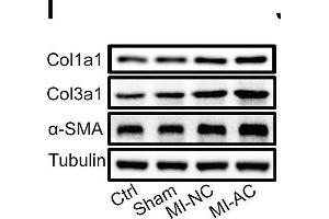 Activated CD4+ T cells-derived exosomes deteriorate cardiac function post-MI in mouse. (COL3A1 Antikörper  (AA 1217-1466))